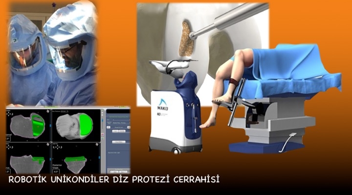 Robotik Unikondiler Diz Protezi Ameliyatı