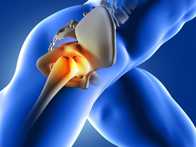 Turkey robotic hip replacement
